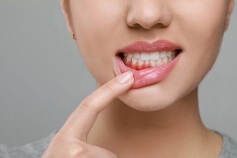 bad oral hygiene habits