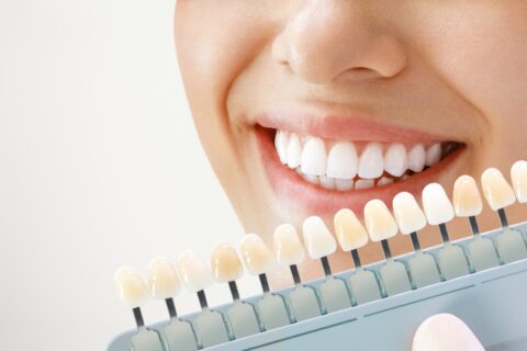 In this blog post, we will explore the least expensive smile makeover options available to gain a beautiful smile without breaking the bank.