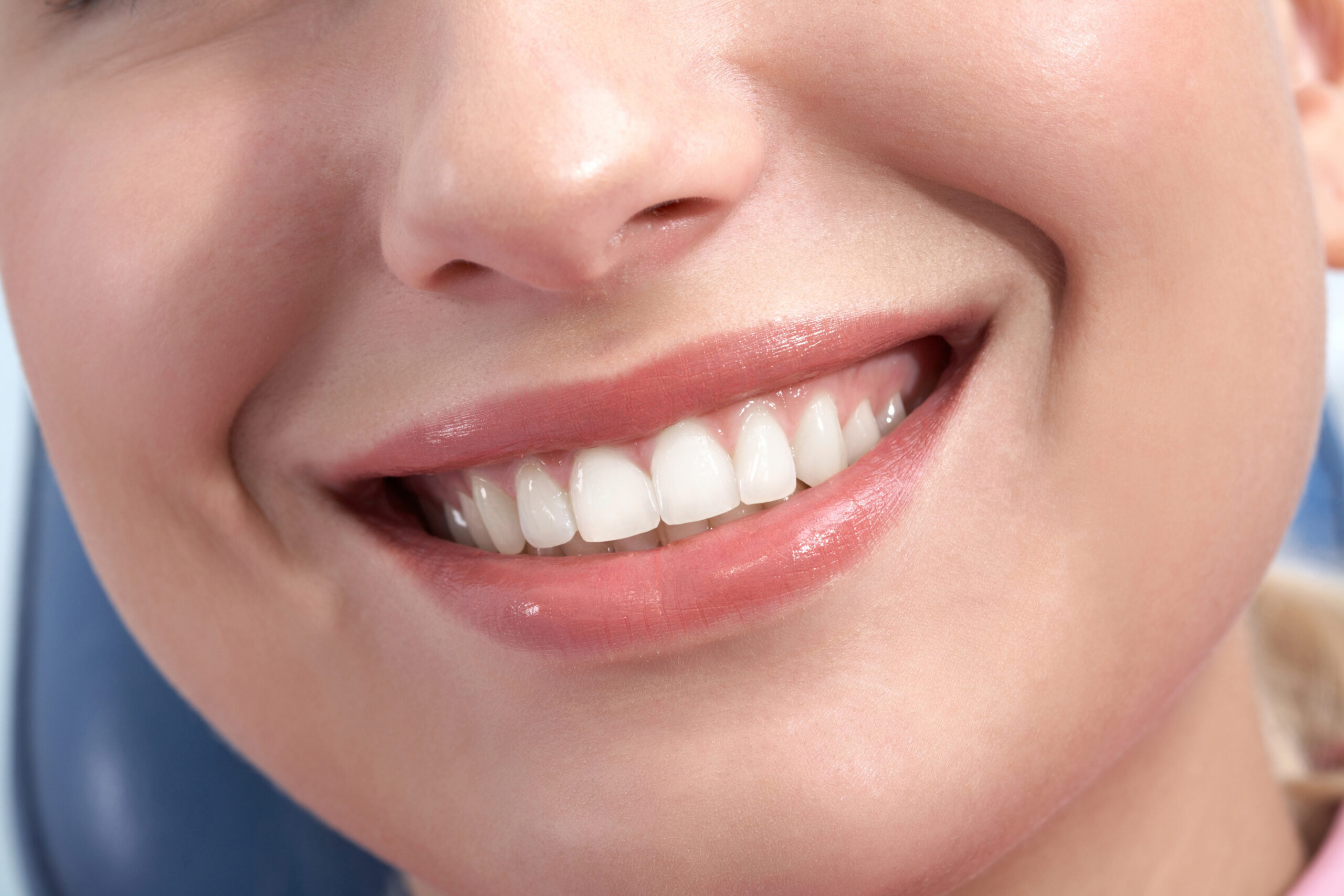 ChatGPT said: Close-up of a woman smiling after teeth bonding treatment.