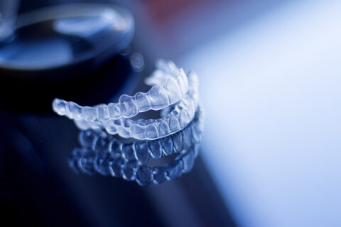 Benefits of Invisalign